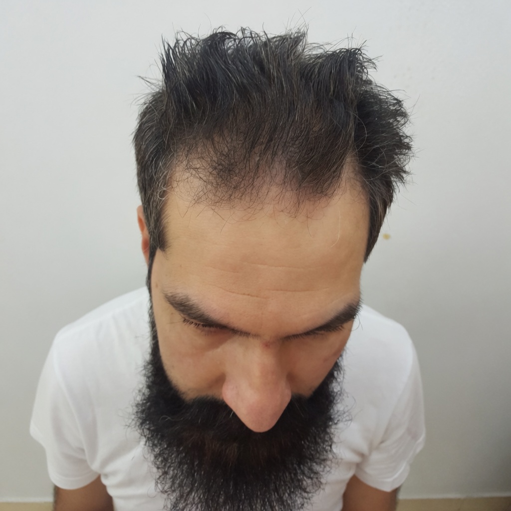 Before