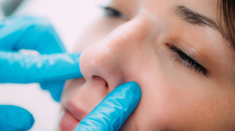 Dermal Fillers. Anti-Aging Treatment Doctor preparing a dermal filler for treatment of a woman’s nose.