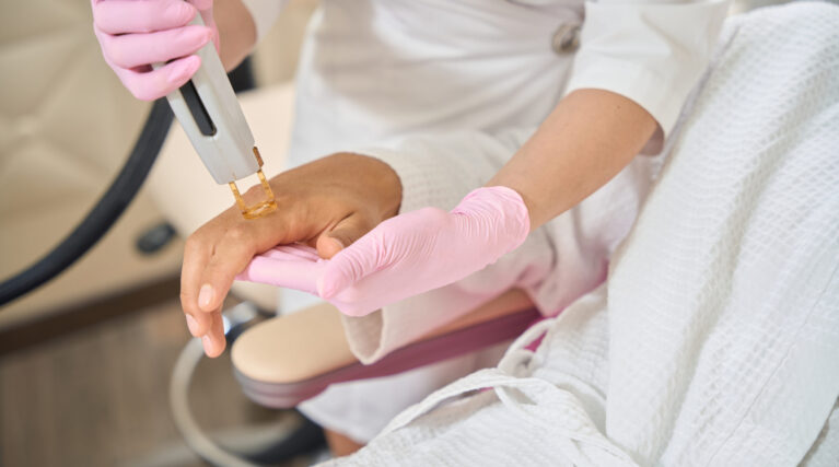 Client at a laser hair removal session for the hands Client at a laser hair removal session for the hands, a cosmetologist uses modern equipment