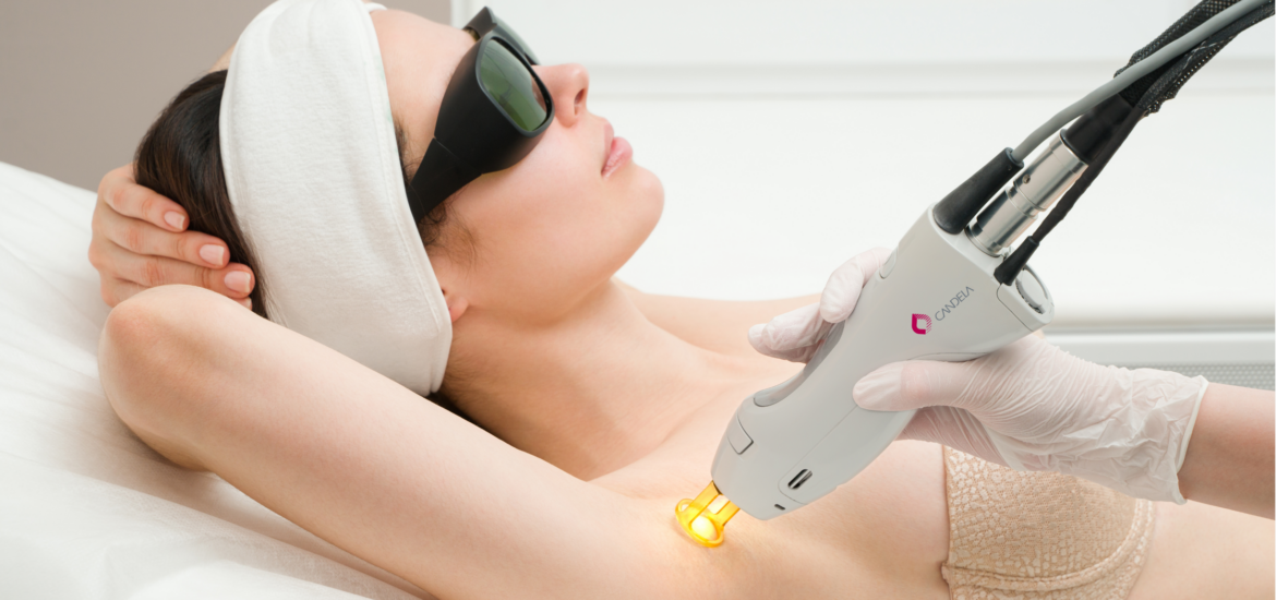 Candela-GentleMax-Pro-Laser-Treatments-procedure