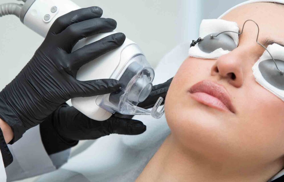 Fractional CO2 Laser