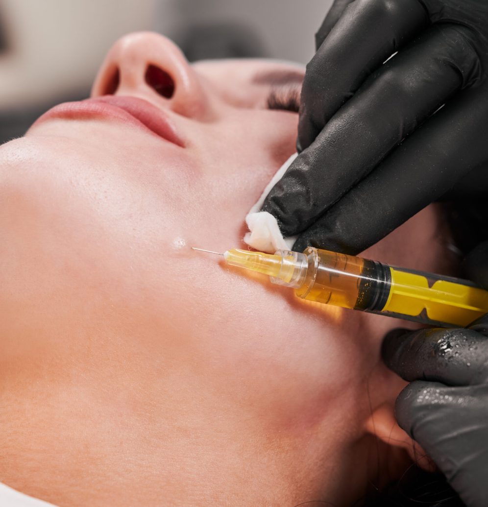 Close-up snapshot of plasmolifting procedure injection. Doctor cosmetologist beautician in black sterile gloves making injection in female patient face. Concept of skincare treatment.