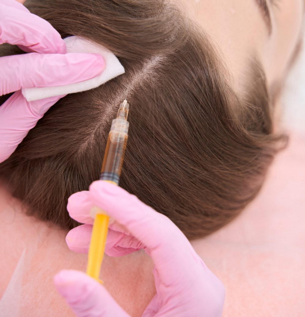 Lady is lying on the procedure of professional facial mesotherapy to improve under skin