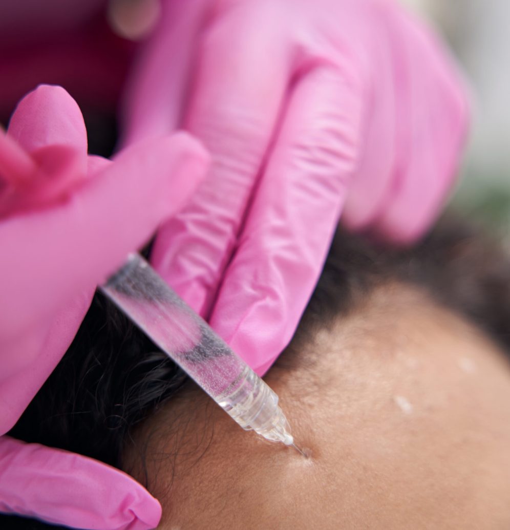 Lady is undergoing a professional facial mesotherapy procedure to improve skin condition