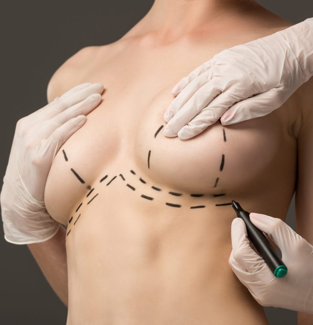 cropped view of plastic surgeon in latex gloves making marks on breast isolated on grey